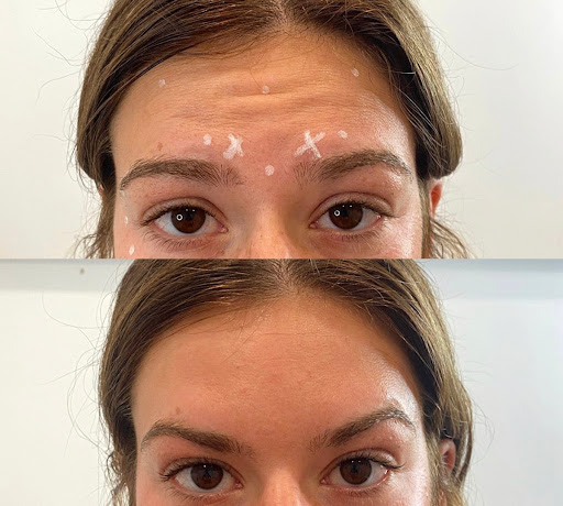 Monroe MedSpa - Buffalo