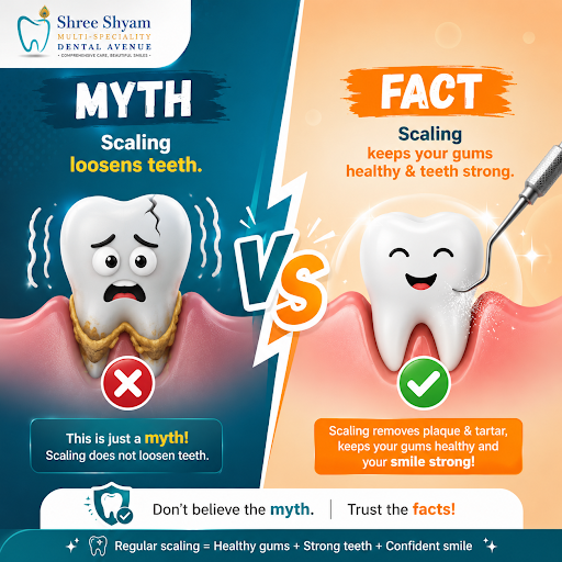 Myth: Scaling loosens your teeth. post image
