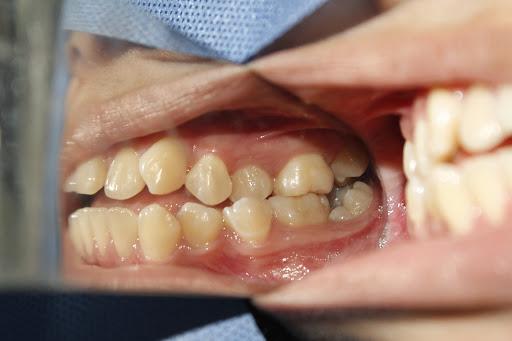 Clínicas Odontológicas de la UJAT-DACS