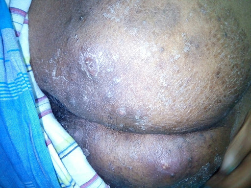 Cured within 2 weeks (Dr Soumya Dey's Clinic desk)  post image