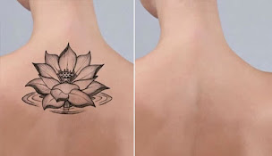 Photo n°4 de Bahlis Samir à Vierzon (Service de détatouage)