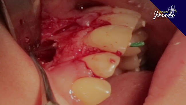 Avaliações sobre Instituto Jarede - Odontologia e Saúde ( Implantes Dentários , Lentes de Contato e Psiquiatra) em Porto Velho - Dentista