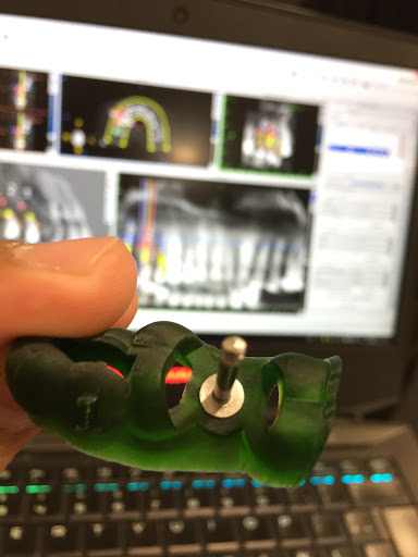Odontología Integral Tepic; Implantes Dentales, Rehabilitación Bucal, Endodoncia. - Thumbnail