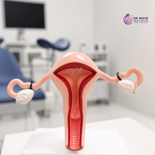 Thinking about permanent birth control and searching for a trusted gynecologist in Indirapuram or… post image