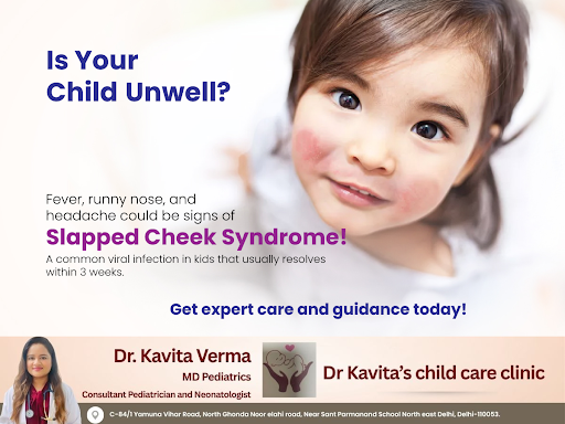 Slapped Cheek Syndrome, also known as Fifth Disease, is a viral infection common in children. It… post image