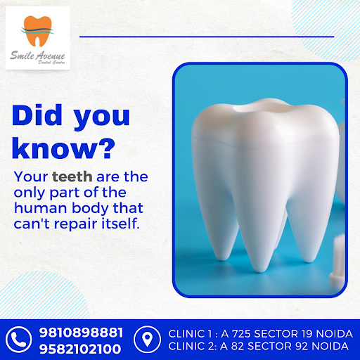Smile Avenue dental clinic is based in #noidacity Our multi-located multi speciality dental pract…