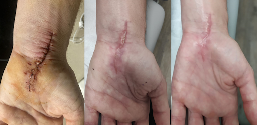 Clínica de Fisioterapia Laura Gil Povill (Gimnasio Altafit) - Thumbnail