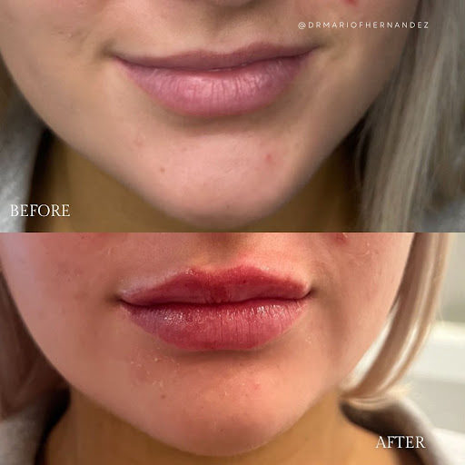 Cell Renew Medical Spa Downtown