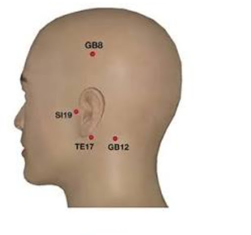 Looking for a Rehabilitation Centre Near Me or Rehab Center Near Me for Stroke Patients & After S…