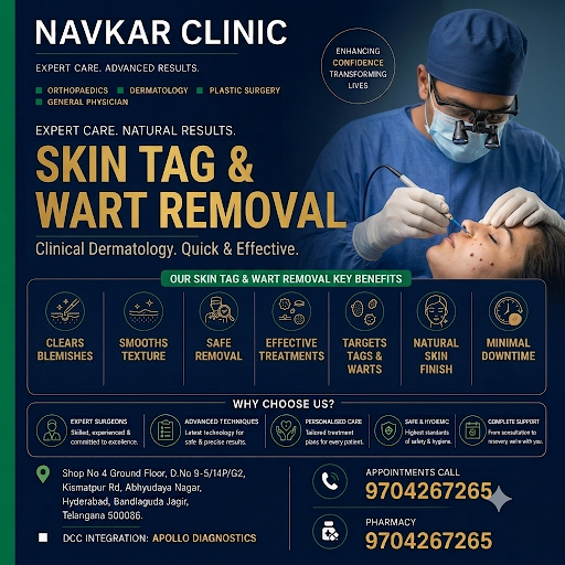 Flawless Skin Awaits: Safe Skin Tag & Wart Removal at NAVKAR Clinic post image