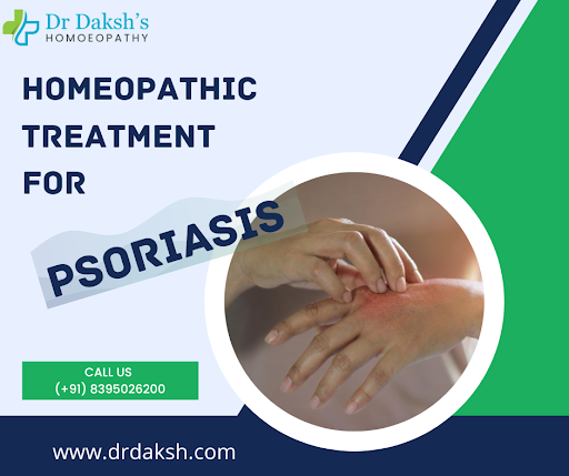 📢 Effective Homeopathic Treatment for Psoriasis in Agra post image