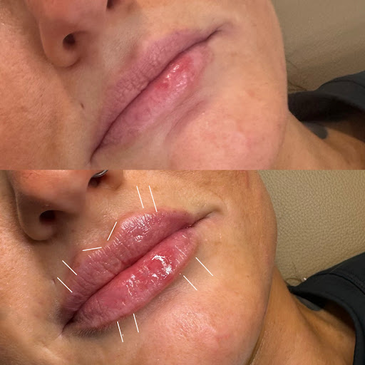 POSH Aesthetics & Wellness