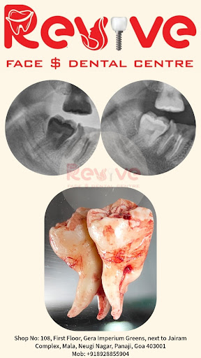 From pain to relief in one visit 😌 post image