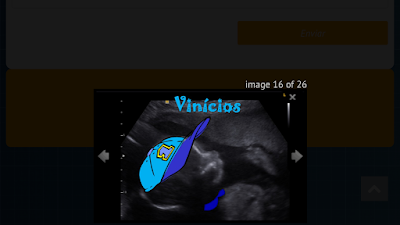 Photos of Ultraimagem Ultrassonografia