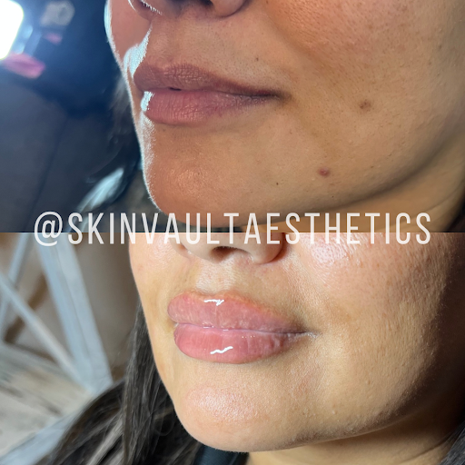Skin Vault Aesthetics & Wellness