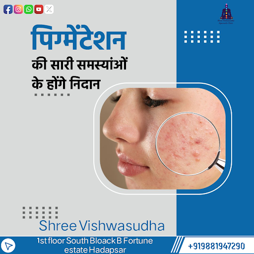 Pigmentation issues like hyperpigmentation (dark patches) or hypopigmentation (light patches) can… post image
