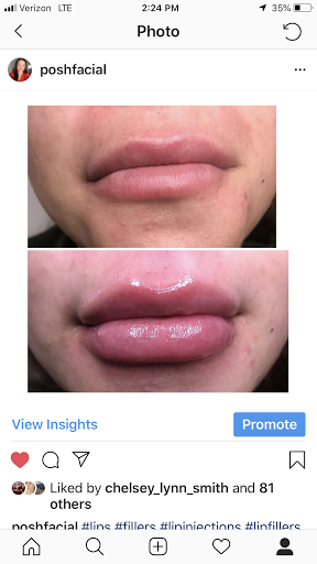 Posh Facial Esthetics & Med Spa
