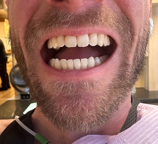 La Jolla Family Smile Design - Thumbnail