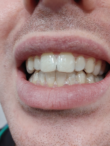 Clínica Dental Diente Sano - Thumbnail