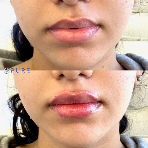 PURE Medical Aesthetics