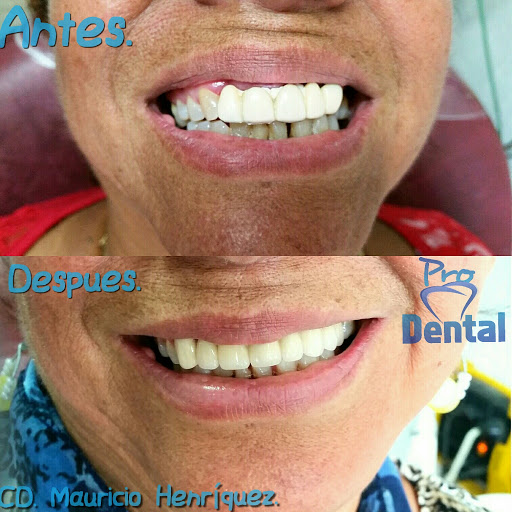 Consultorio dental ProDental San Cristóbal de Las Casas - Thumbnail