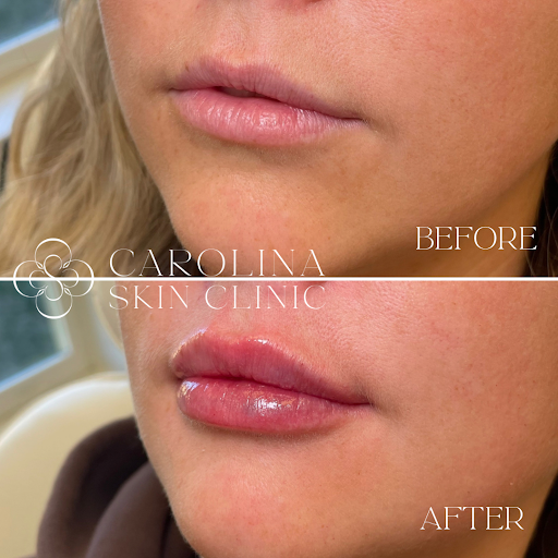 Carolina Skin Clinic