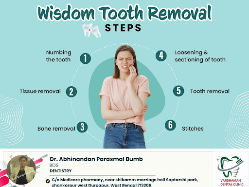 Wisdom Tooth Removal: Steps post image