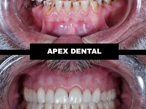 Dental Clinic Apex Dental Gulbarga post image