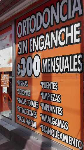 Control SPA Gallery - Mexico