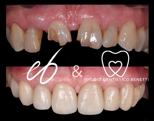 Studio Dentistico Benetti Montresor - Dentista Raldon San Giovanni Lupatoto - Thumbnail