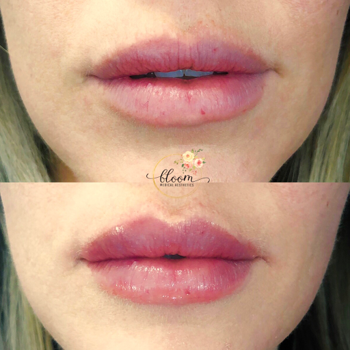 Bloom Medical Aesthetics