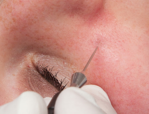 Lineva Aesthetics