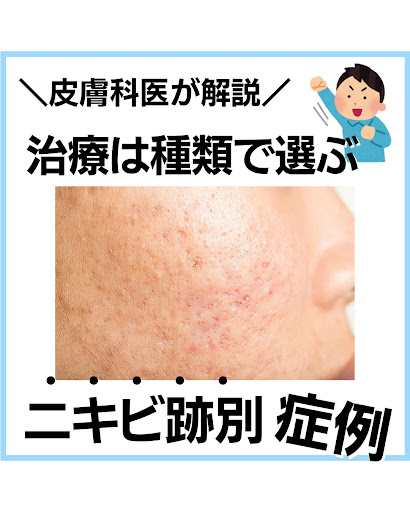 池袋の皮膚科】池袋駅前のだ皮膚科｜池袋駅すぐ｜夜間・土日診療