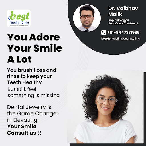 Dental jewelry is customized to add that Glint to your Beautiful Smile. They last up to 6 months… post image
