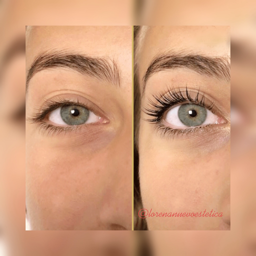 Lorena Nuevo Estética Avanzada - Thumbnail