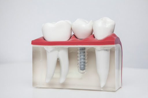 Mind Dental B.V. - Thumbnail