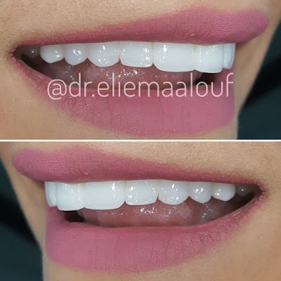 Photos of Maalouf Dental Clinic-Dr. Elie maalouf
