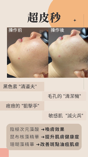 放鬆美學spa館苓雅店評價、價格、網友推薦資訊 - 深層清粉刺與臉部護理