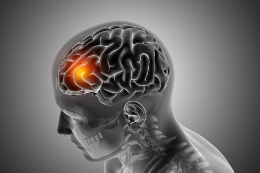 Brain tumors, whether benign or malignant, demand prompt evaluation and expert intervention. Symp…