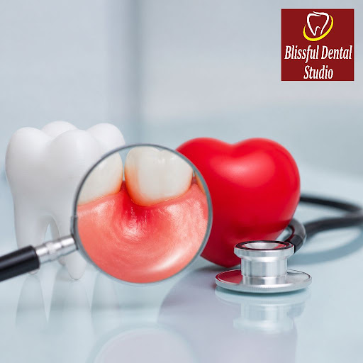 Did you know that bleeding gums and persistent gum inflammation can affect more than just your sm… post image