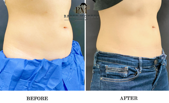 Bared Monkey Laser Spa by null