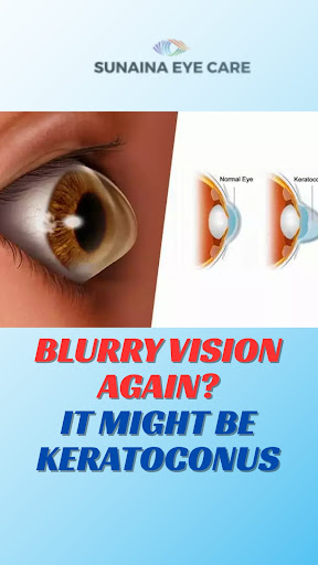 *Keratoconus: When Your Eye Changes Its Shape 👁️* post image