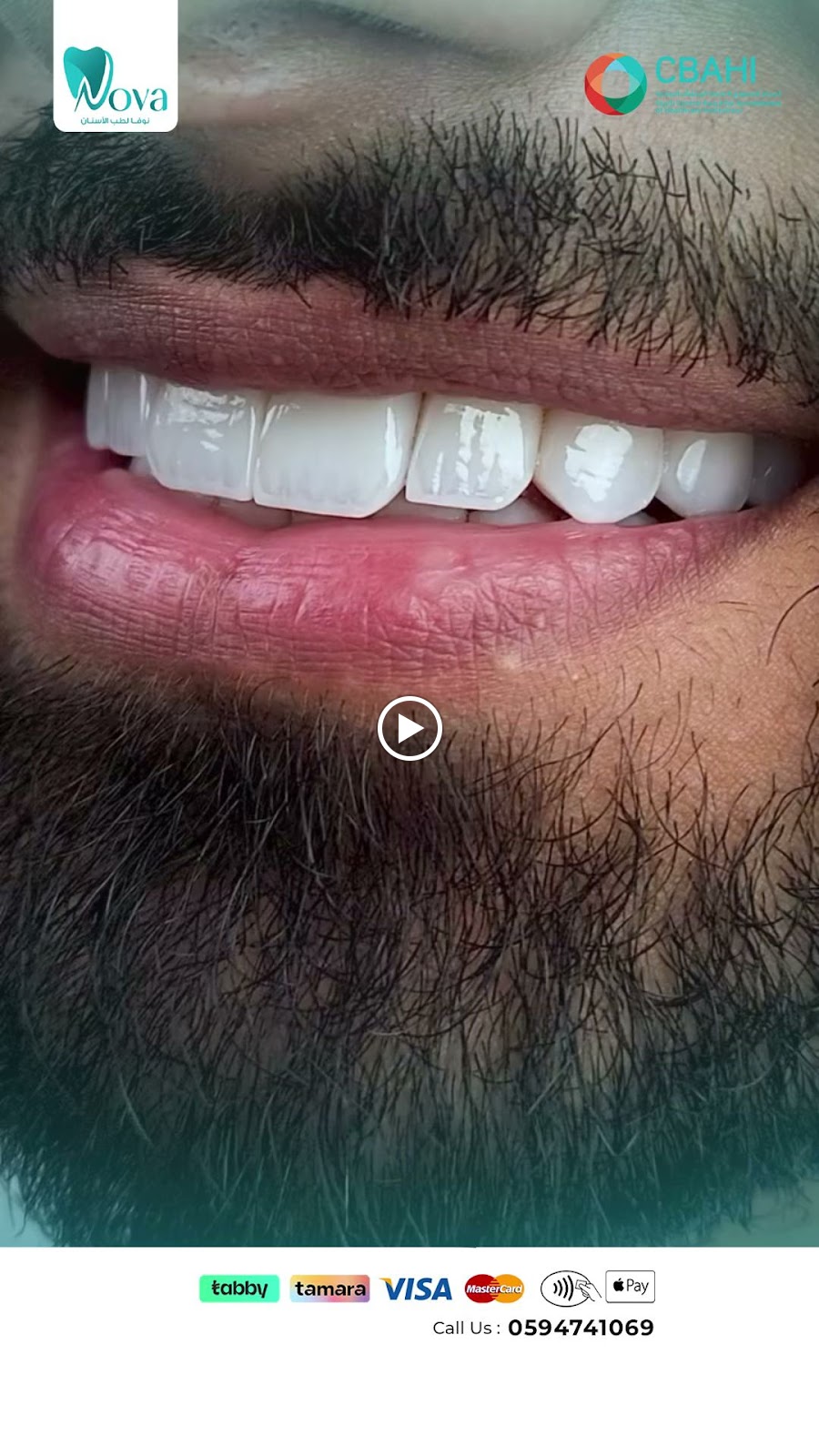 مجمع نوفا لطب الأسنان - المدينة المنورة - صورة 2