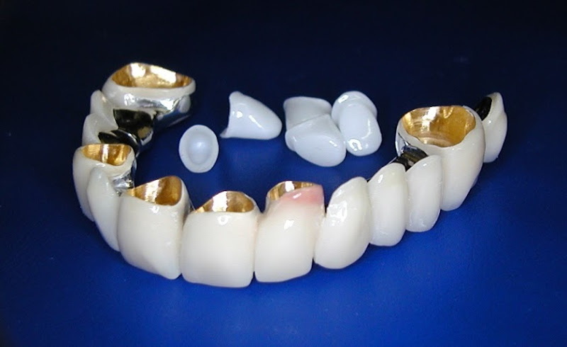 PS Dentaltechnik GmbH