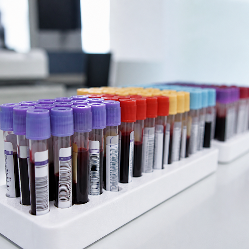 Get complete clarity on your health with detailed blood tests and honest, upfront pricing at WELL… post image
