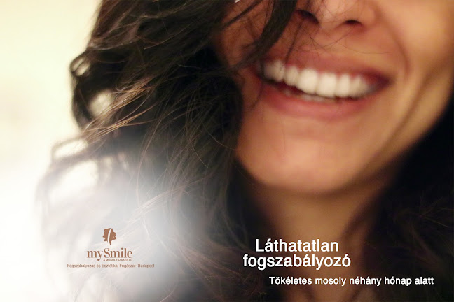 mySmile- Orvosi Centrum - Fogszabályozás és Orvosesztétika - Budapest