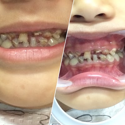 Photos of K_vity Family Dental Gallery--Dokter gigi anak Henri Hartman,drg.Sp.KGA