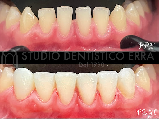 Studio Dentistico Dr. Erra - Thumbnail