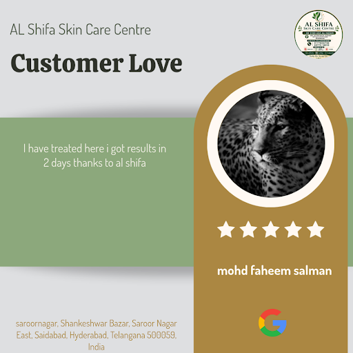 Mohd Faheem Salman's exceptional experience with our team at AL Shifa Skin Care Centre, Hyderabad… post image