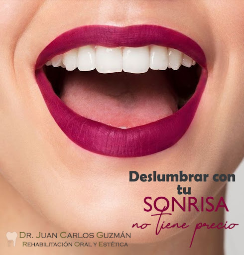Dr. Juan Carlos Guzmán Castañeda - Rehabilitación Oral y Estética - Thumbnail